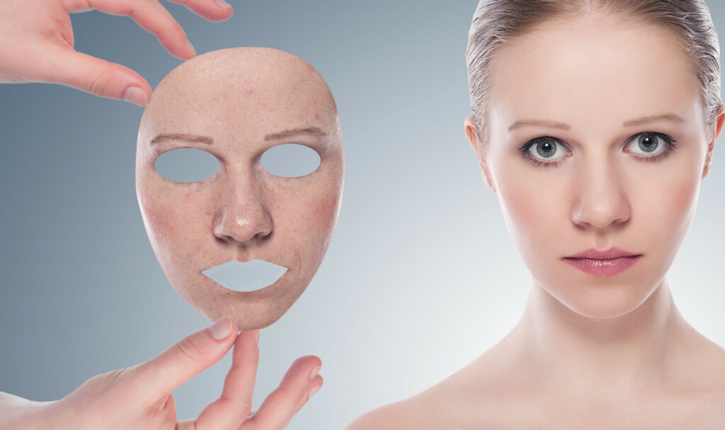 Vorher Nachher Fotos von IPL Skin Rejuvenation Kurpaket